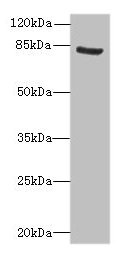 Western blot  | All lanes: NOL10 antibody at 8µg/ml + K562 whole cell lysate  | Secondary  | Goat polyclonal to rabbit IgG at 1/10000 dilution  | Predicted band size: 81, 75, 22, 78 kDa  | Observed band size: 81 kDaRabbit anti-Human NOL10 Polyclonal Antibody