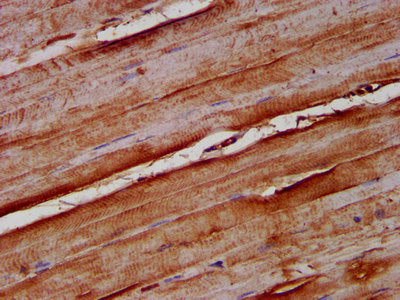 IHC image of NOMO1 Antibody diluted at 1:100 and staining in paraffin-embedded human skeletal muscle tissue performed on a Leica BondTM system. After dewaxing and hydration, antigen retrieval was mediated by high pressure in a citrate buffer (pH 6.0). Section was blocked with 10% normal goat serum 30min at RT. Then primary antibody (1% BSA) was incubated at 4°C overnight. The primary is detected by a biotinylated secondary antibody and visualized using an HRP conjugated SP system.Rabbit anti-Human NOMO1 Polyclonal Antibody