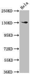 Western Blot  | Positive WB detected in: Hela whole cell lysate  | All lanes: NOMO1 antibody at 3µg/ml  | Secondary  | Goat polyclonal to rabbit IgG at 1/50000 dilution  | Predicted band size: 135 kDa  | Observed band size: 135 kDaRabbit anti-Human NOMO1 Polyclonal Antibody