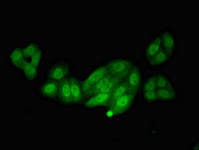 Immunofluorescent analysis of HepG2 cells using NOS1AP Antibody at dilution of 1:100 and Alexa Fluor 488-congugated AffiniPure Goat Anti-Rabbit IgG(H+L)Rabbit anti-Human NOS1AP Polyclonal Antibody