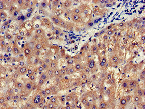 Immunohistochemistry of paraffin-embedded human liver tissue using the antibody at dilution of 1:100Rabbit anti-Human NOS1AP Polyclonal Antibody