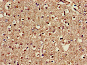 Immunohistochemistry of paraffin-embedded human brain tissue using NOS1AP Antibody at dilution of 1:100Rabbit anti-Human NOS1AP Polyclonal Antibody