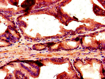 Immunohistochemistry of paraffin-embedded human prostate tissue using the antibody at dilution of 1:100Rabbit anti-Human NOX1 Polyclonal Antibody