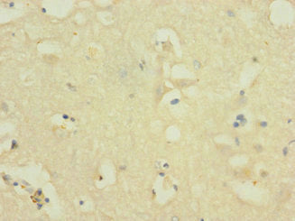 Immunohistochemistry of paraffin-embedded human brain tissue using NOX3 Antibody at dilution of 1:100Rabbit anti-Human NOX3 Polyclonal Antibody