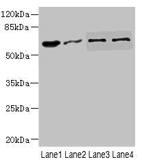Western blot | All lanes: NOX3antibody at 0.96μg/ml | Lane 1: Mouse kidney tissue | Lane 2: 293T whole cell lysate | Lane 3: HepG2 whole cell lysate | Lane 4: Hela whole cell lysate | Secondary | Goat polyclonal to rabbit IgG at 1/10000 dilution | Predicted band size: 65 kDa | Observed band size: 65 kDaRabbit anti-Human NOX3 Polyclonal Antibody