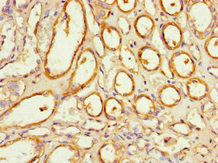 Immunohistochemistry of paraffin-embedded human kidney tissue using NOXA1 Antibody at dilution of 1:100Rabbit anti-Human NOXA1 Polyclonal Antibody