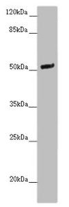 Western blot | All lanes: NOXA1 antibody at 2 μg/ml + Mouse brain tissue | Secondary | Goat polyclonal to rabbit IgG at 1/10000 dilution | Predicted band size: 51, 52, 46 kDa | Observed band size: 51 kDaRabbit anti-Human NOXA1 Polyclonal Antibody