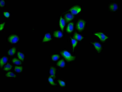 Immunofluorescence staining of Hela cells with NOXO1 Antibody at 1:66, counter-stained with DAPI. The cells were fixed in 4% formaldehyde, permeabilized using 0.2% Triton X-100 and blocked in 10% normal Goat Serum. The cells were then incubated with the antibody overnight at 4°C. The secondary antibody was Alexa Fluor 488-congugated AffiniPure Goat Anti-Rabbit IgG(H+L).Rabbit anti-Human NOXO1 Polyclonal Antibody