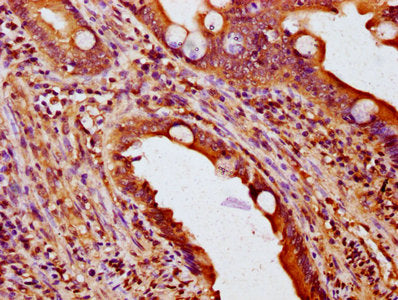 IHC image of NOXO1 Antibody diluted at 1:200 and staining in paraffin-embedded human small intestine tissue performed on a Leica BondTM system. After dewaxing and hydration, antigen retrieval was mediated by high pressure in a citrate buffer (pH 6.0). Section was blocked with 10% normal goat serum 30min at RT. Then primary antibody (1% BSA) was incubated at 4°C overnight. The primary is detected by a biotinylated secondary antibody and visualized using an HRP conjugated SP system.Rabbit anti-Human NOXO1 Polyclonal Antibody