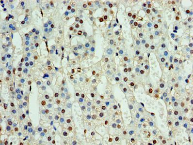 Immunohistochemistry of paraffin-embedded human adrenal gland tissue using the antibody at dilution of 1:100Rabbit anti-Human NPHP1 Polyclonal Antibody
