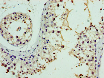 Immunohistochemistry of paraffin-embedded human testis tissue using NPHP1 Antibody at dilution of 1:100Rabbit anti-Human NPHP1 Polyclonal Antibody