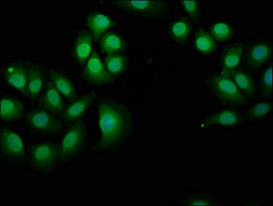 Immunofluorescence staining of A549 cells with NPHP4 Antibody at 1:166, counter-stained with DAPI. The cells were fixed in 4% formaldehyde, permeabilized using 0.2% Triton X-100 and blocked in 10% normal Goat Serum. The cells were then incubated with the antibody overnight at 4°C. The secondary antibody was Alexa Fluor 488-congugated AffiniPure Goat Anti-Rabbit IgG(H+L).