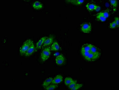 Immunofluorescence staining of HepG2 cells with NPHS1 Antibody at 1:125, counter-stained with DAPI. The cells were fixed in 4% formaldehyde, permeabilized using 0.2% Triton X-100 and blocked in 10% normal Goat Serum. The cells were then incubated with the antibody overnight at 4°C. The secondary antibody was Alexa Fluor 488-congugated AffiniPure Goat Anti-Rabbit IgG(H+L).Rabbit anti-Human NPHS1 Polyclonal Antibody