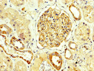 IHC image of the antibody diluted at 1:250 and staining in paraffin-embedded human kidney tissue performed on a Leica BondTM system. After dewaxing and hydration, antigen retrieval was mediated by high pressure in a citrate buffer (pH 6.0). Section was blocked with 10% normal goat serum 30min at RT. Then primary antibody (1% BSA) was incubated at 4°C overnight. The primary is detected by a biotinylated secondary antibody and visualized using an HRP conjugated SP system.Rabbit anti-Human NPHS1 Polyclonal Antibody