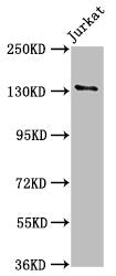 Western Blot  | Positive WB detected in: Jurkat whole cell lysate  | All lanes: NPHS1 antibody at 5.6µg/ml  | Secondary  | Goat polyclonal to rabbit IgG at 1/50000 dilution  | Predicted band size: 135, 131 kDa  | Observed band size: 135 kDaRabbit anti-Human NPHS1 Polyclonal Antibody