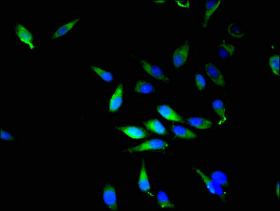 Immunofluorescent analysis of Hela cells using NQO2 Antibody at dilution of 1:100 and Alexa Fluor 488-congugated AffiniPure Goat Anti-Rabbit IgG(H+L)Rabbit anti-Human NQO2 Polyclonal Antibody