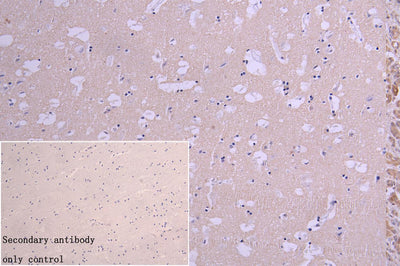 Immunohistochemistry of paraffin-embedded human brain tissue using NQO2 Antibody at dilution of 1:100Rabbit anti-Human NQO2 Polyclonal Antibody