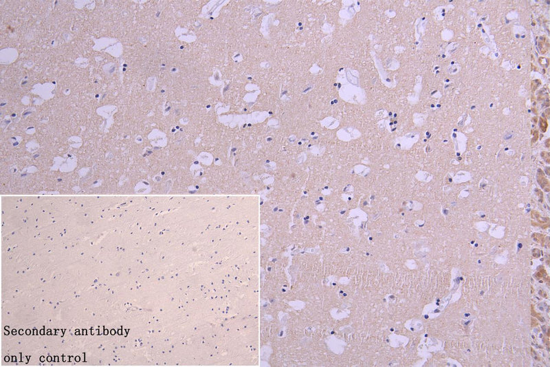 Immunohistochemistry of paraffin-embedded human brain tissue using NQO2 Antibody at dilution of 1:100Rabbit anti-Human NQO2 Polyclonal Antibody