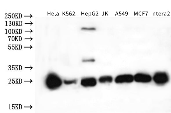 Western Blot | Positive WB detected in: K562 whole cell lysate, Mouse liver tissue | All lanes: NQO2 antibody at 3μg/ml | Secondary | Goat polyclonal to rabbit IgG at 1/50000 dilution | Predicted band size: 26 kDa | Observed band size: 26 kDaRabbit anti-Human NQO2 Polyclonal Antibody