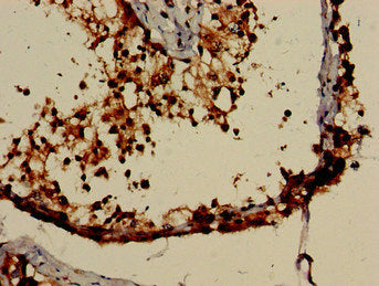 Immunohistochemistry of paraffin-embedded human testis tissue using NR0B1 Antibody at dilution of 1:100Rabbit anti-Human NR0B1 Polyclonal Antibody