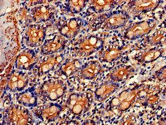 Immunohistochemistry of paraffin-embedded human small intestine tissue using NR0B1 Antibody at dilution of 1:100Rabbit anti-Human NR0B1 Polyclonal Antibody