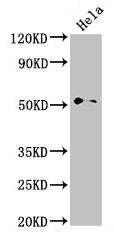 Western Blot  | Positive WB detected in: Hela whole cell lysate  | All lanes: NR0B1 antibody at 2.8µg/ml  | Secondary  | Goat polyclonal to rabbit IgG at 1/50000 dilution  | Predicted band size: 52, 44 kDa  | Observed band size: 52 kDaRabbit anti-Human NR0B1 Polyclonal Antibody