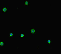 Immunofluorescent analysis of HepG2 cells using NR1H2 Antibody at dilution of 1:100 and Alexa Fluor 488-congugated AffiniPure Goat Anti-Rabbit IgG(H+L)Rabbit anti-Human NR1H2 Polyclonal Antibody