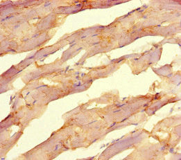 Immunohistochemistry of paraffin-embedded human skeletal muscle tissue using NR1H2 Antibody at dilution of 1:100Rabbit anti-Human NR1H2 Polyclonal Antibody