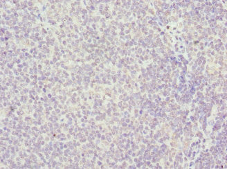 Immunohistochemistry of paraffin-embedded human tonsil tissue using HMGB1 Antibody at dilution of 1:100Rabbit anti-Human HMGB1 Polyclonal Antibody