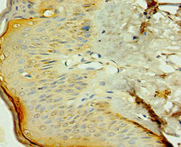 Immunohistochemistry of paraffin-embedded human skin tissue using the antibody at dilution of 1:100Rabbit anti-Human NR2C2 Polyclonal Antibody