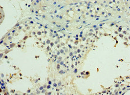 Immunohistochemistry of paraffin-embedded human testis tissue using NR2C2 Antibody at dilution of 1:100Rabbit anti-Human NR2C2 Polyclonal Antibody