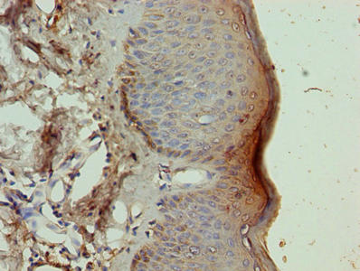 Immunohistochemistry of paraffin-embedded human skin tissue using NR2C2AP Antibody at dilution of 1:100Rabbit anti-Human NR2C2AP Polyclonal Antibody