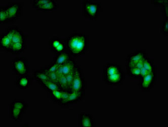 Immunofluorescent analysis of HepG2 cells using NR3C1 Antibody at dilution of 1:100 and Alexa Fluor 488-congugated AffiniPure Goat Anti-Rabbit IgG(H+L)Rabbit anti-Human NR3C1 Polyclonal Antibody