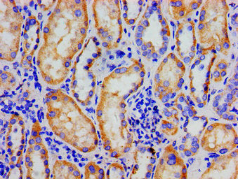 Immunohistochemistry of paraffin-embedded human kidney tissue using NR3C1 Antibody at dilution of 1:100Rabbit anti-Human NR3C1 Polyclonal Antibody