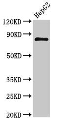 Western Blot  | Positive WB detected in: HepG2 whole cell lysate  | All lanes: NR3C1 antibody at 3µg/ml  | Secondary  | Goat polyclonal to rabbit IgG at 1/50000 dilution  | Predicted band size: 86, 82, 65, 61, 83, 79, 77, 76, 52, 51, 50 kDa  | Observed band size: 86 kDaRabbit anti-Human NR3C1 Polyclonal Antibody