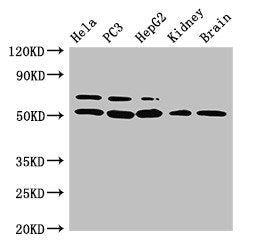 Western Blot | Positive WB detected in: Hela whole cell lysate, PC-3 whole cell lysate, HepG2 whole cell lysate, Mouse kidney tissue, Mouse brain tissue | All lanes: NR5A2 antibody at 3μg/ml | Secondary | Goat polyclonal to rabbit IgG at 1/50000 dilution | Predicted band size: 62, 57, 43, 54 kDa | Observed band size: 62, 54 kDaRabbit anti-Human NR5A2 Polyclonal Antibody