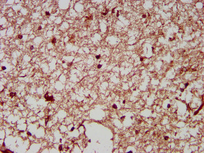 IHC image of NRCAM Antibody diluted at 1:200 and staining in paraffin-embedded human brain tissue performed on a Leica BondTM system. After dewaxing and hydration, antigen retrieval was mediated by high pressure in a citrate buffer (pH 6.0). Section was blocked with 10% normal goat serum 30min at RT. Then primary antibody (1% BSA) was incubated at 4°C overnight. The primary is detected by a biotinylated secondary antibody and visualized using an HRP conjugated SP system.Rabbit anti-Human NRCAM Polyclonal Antibody
