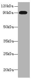 Western blot  | All lanes: NRG2 antibody at 16µg/ml + U251 whole cell lysate  | Secondary  | Goat polyclonal to rabbit IgG at 1/10000 dilution  | Predicted band size: 92, 91, 93, 47, 46, 68, 71 kDa  | Observed band size: 92 kDaRabbit anti-Human NRG2 Polyclonal Antibody