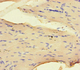 Immunohistochemistry of paraffin-embedded human skeletal muscle tissue using NRP2 Antibody at dilution of 1:100Rabbit anti-Human NRP2 Polyclonal Antibody