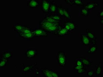 Immunofluorescent analysis of Hela cells using NTHL1 Antibody at dilution of 1:100 and Alexa Fluor 488-congugated AffiniPure Goat Anti-Rabbit IgG(H+L)Rabbit anti-Human NTHL1 Polyclonal Antibody