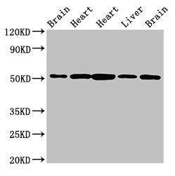 Western Blot | Positive WB detected in: Rat brain tissue, Rat heart tissue, Mouse heart tissue, Mouse liver tissue, Mouse brain tissue | All lanes: NUCB2 antibody at 2.5μg/ml | Secondary | Goat polyclonal to rabbit IgG at 1/50000 dilution | Predicted band size: 51 kDa | Observed band size: 51 kDaRabbit anti-Human NUCB2 Polyclonal Antibody