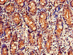 Immunohistochemistry of paraffin-embedded human small intestine tissue using the antibody at dilution of 1:100Rabbit anti-Human NUDT1 Polyclonal Antibody