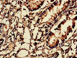 Immunohistochemistry of paraffin-embedded human appendix tissue using NUDT1 Antibody at dilution of 1:100Rabbit anti-Human NUDT1 Polyclonal Antibody