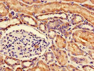 Immunohistochemistry of paraffin-embedded human kidney tissue using NUDT21 Antibody at dilution of 1:100Rabbit anti-Human NUDT21 Polyclonal Antibody