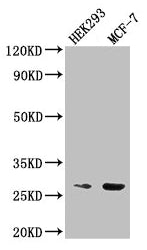 Western Blot  | Positive WB detected in: HEK293 whole cell lysate, MCF-7 whole cell lysate  | All lanes: NUDT21 antibody at 2.5µg/ml  | Secondary  | Goat polyclonal to rabbit IgG at 1/50000 dilution  | Predicted band size: 27 kDa  | Observed band size: 27 kDaRabbit anti-Human NUDT21 Polyclonal Antibody