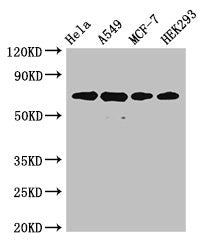 Western Blot  | Positive WB detected in: Hela whole cell lysate, A549 whole cell lysate, MCF-7 whole cell lysate, HEK293 whole cell lysate  | All lanes: XRCC6 antibody at 4µg/ml  | Secondary  | Goat polyclonal to rabbit IgG at 1/50000 dilution  | Predicted band size: 70, 66 kDa  | Observed band size: 70 kDaRabbit anti-Human XRCC6 Polyclonal Antibody