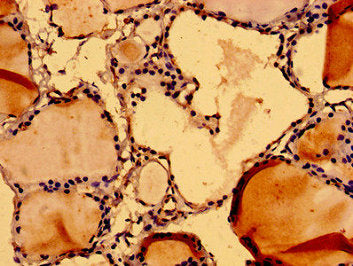 Immunohistochemistry of paraffin-embedded human thyroid tissue using NUMA1 Antibody at dilution of 1:100Rabbit anti-Human NUMA1 Polyclonal Antibody