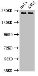 Western Blot  | Positive WB detected in: Hela whole cell lysate, K562 whole cell lysate  | All lanes: NUMA1 antibody at 3.2µg/ml  | Secondary  | Goat polyclonal to rabbit IgG at 1/50000 dilution  | Predicted band size: 239, 237, 202, 201, 110 kDa  | Observed band size: 239 kDaRabbit anti-Human NUMA1 Polyclonal Antibody