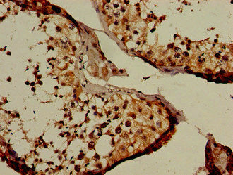 Immunohistochemistry of paraffin-embedded human testis tissue using NUP107 Antibody at dilution of 1:100Rabbit anti-Human NUP107 Polyclonal Antibody
