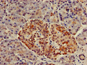Immunohistochemistry of paraffin-embedded human pancreatic tissue using NUP107 Antibody at dilution of 1:100Rabbit anti-Human NUP107 Polyclonal Antibody